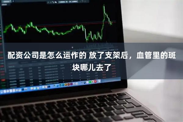 配资公司是怎么运作的 放了支架后，血管里的斑块哪儿去了